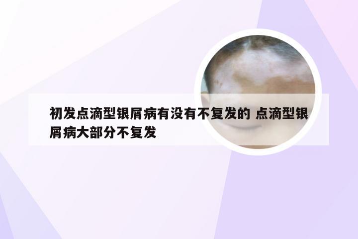 初发点滴型银屑病有没有不复发的 点滴型银屑病大部分不复发