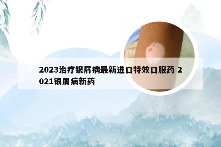 2023治疗银屑病最新进口特效口服药 2021银屑病新药