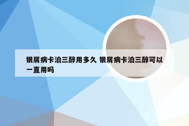 银屑病卡泊三醇用多久 银屑病卡泊三醇可以一直用吗