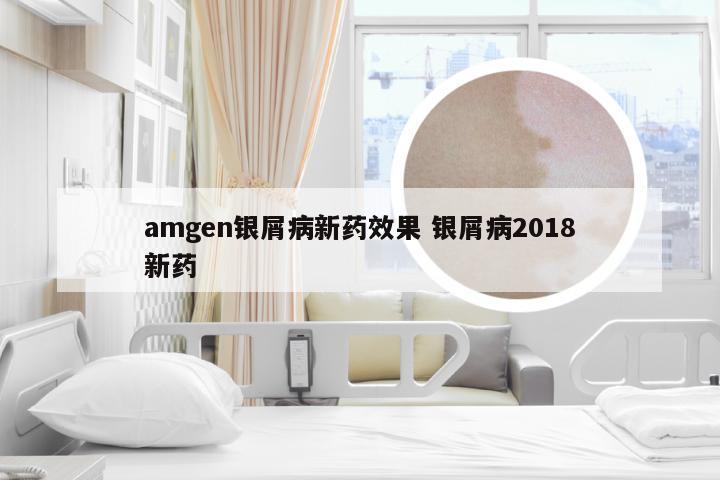 amgen银屑病新药效果 银屑病2018新药