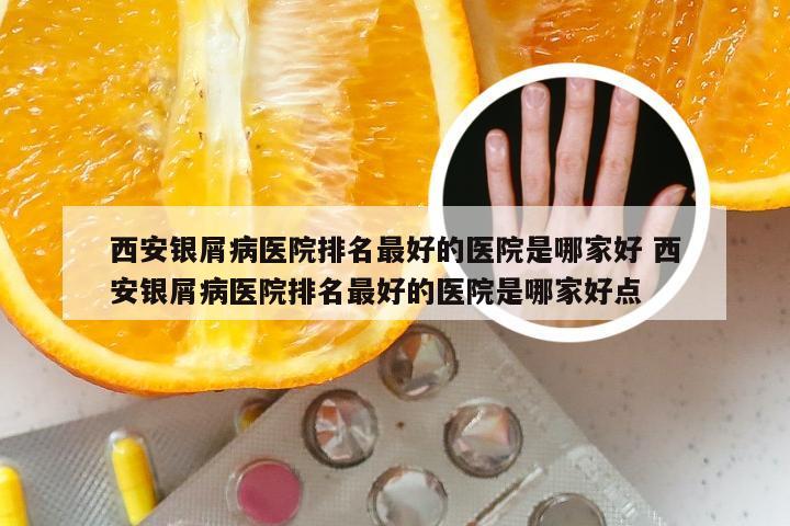 西安银屑病医院排名最好的医院是哪家好 西安银屑病医院排名最好的医院是哪家好点