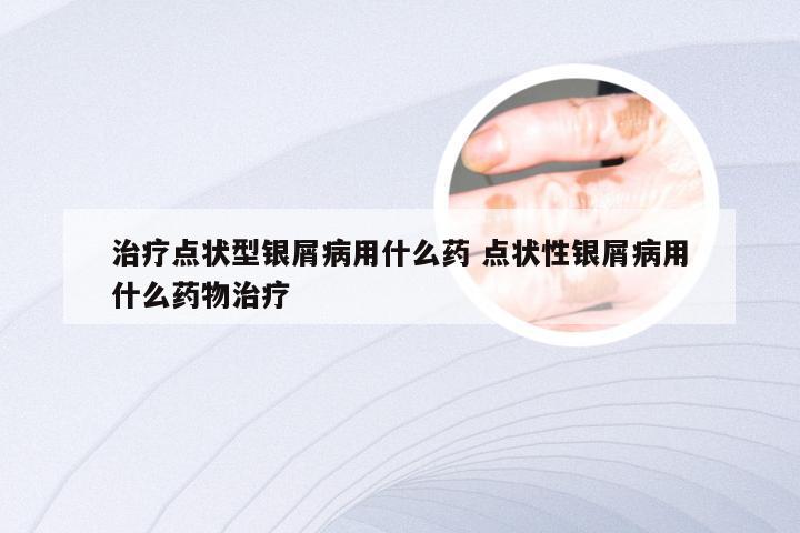 治疗点状型银屑病用什么药 点状性银屑病用什么药物治疗