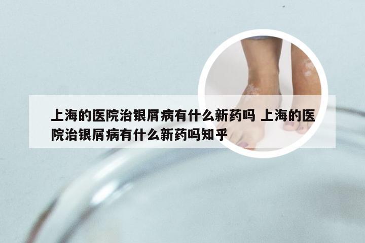 上海的医院治银屑病有什么新药吗 上海的医院治银屑病有什么新药吗知乎