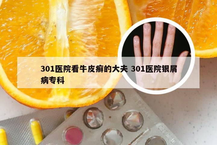 301医院看牛皮癣的大夫 301医院银屑病专科