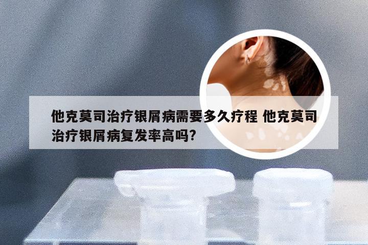 他克莫司治疗银屑病需要多久疗程 他克莫司治疗银屑病复发率高吗?