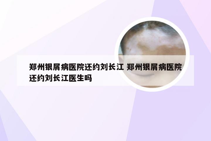 郑州银屑病医院还约刘长江 郑州银屑病医院还约刘长江医生吗