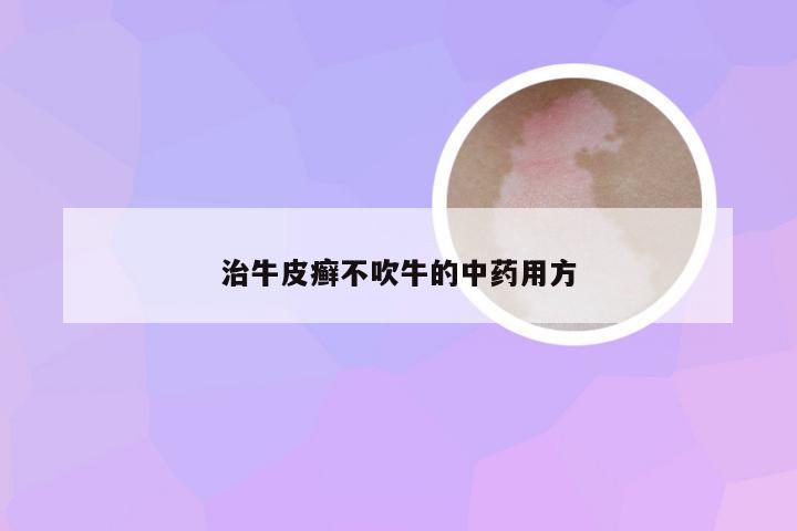 治牛皮癣不吹牛的中药用方