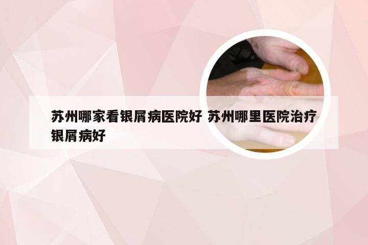 苏州哪家看银屑病医院好 苏州哪里医院治疗银屑病好