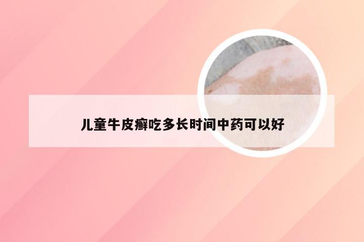 儿童牛皮癣吃多长时间中药可以好