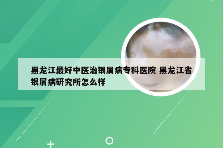 黑龙江最好中医治银屑病专科医院 黑龙江省银屑病研究所怎么样