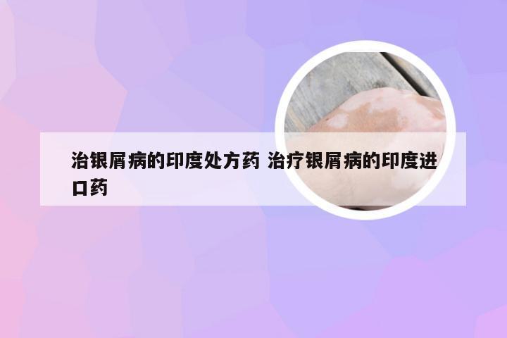 治银屑病的印度处方药 治疗银屑病的印度进口药