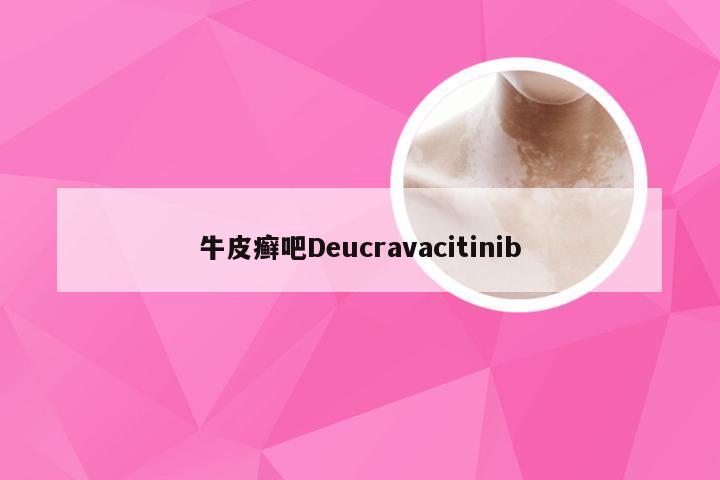 牛皮癣吧Deucravacitinib