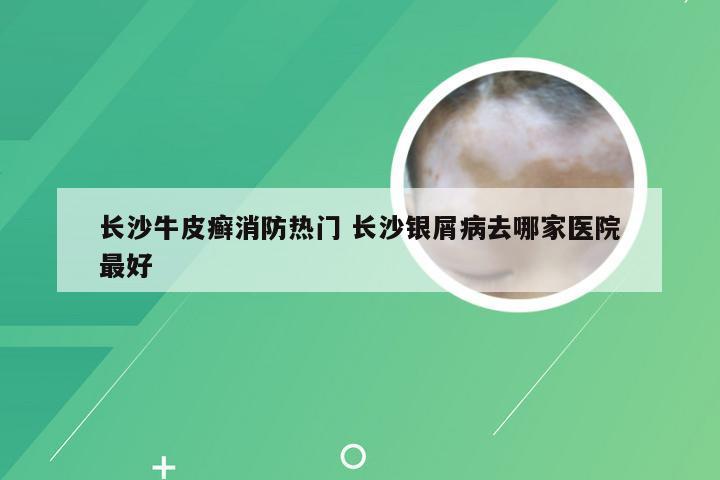 长沙牛皮癣消防热门 长沙银屑病去哪家医院最好