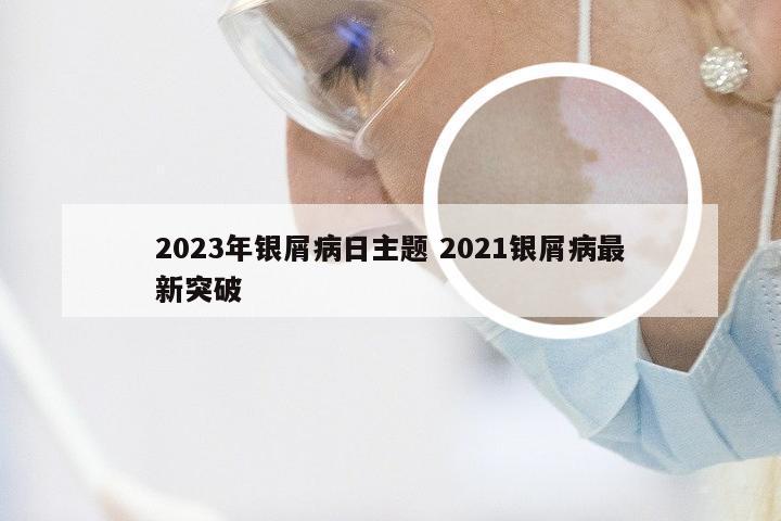 2023年银屑病日主题 2021银屑病最新突破