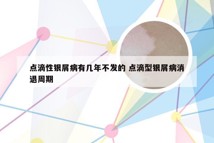 点滴性银屑病有几年不发的 点滴型银屑病消退周期