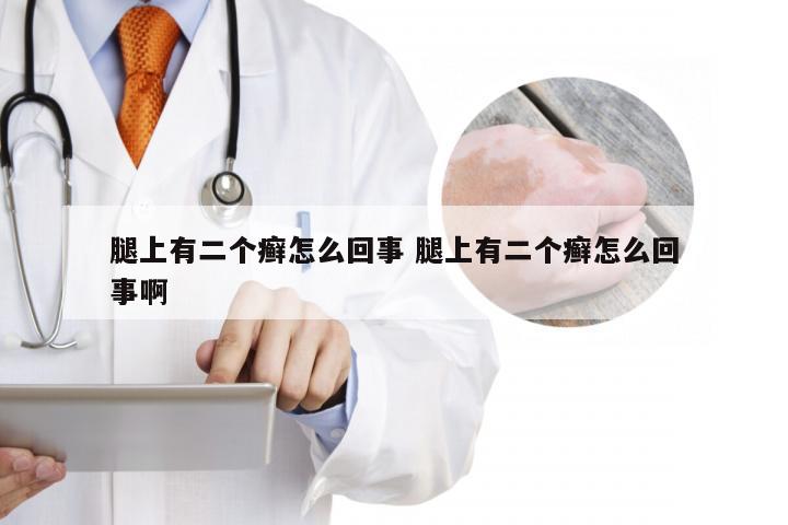 腿上有二个癣怎么回事 腿上有二个癣怎么回事啊