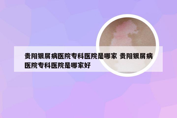 贵阳银屑病医院专科医院是哪家 贵阳银屑病医院专科医院是哪家好