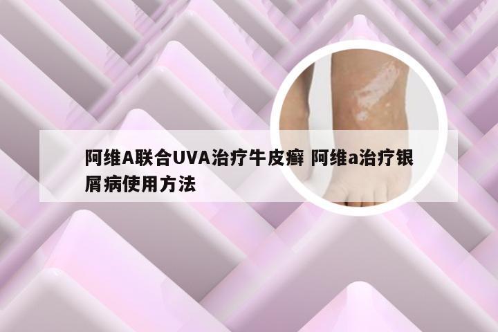 阿维A联合UVA治疗牛皮癣 阿维a治疗银屑病使用方法