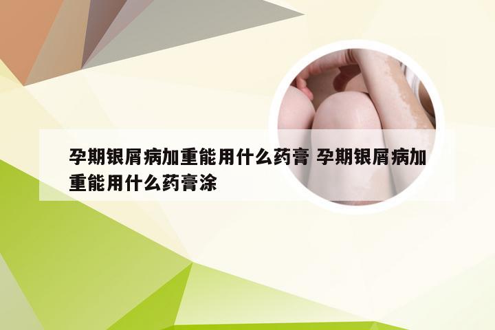 孕期银屑病加重能用什么药膏 孕期银屑病加重能用什么药膏涂