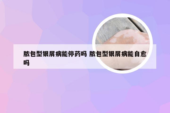 脓包型银屑病能停药吗 脓包型银屑病能自愈吗