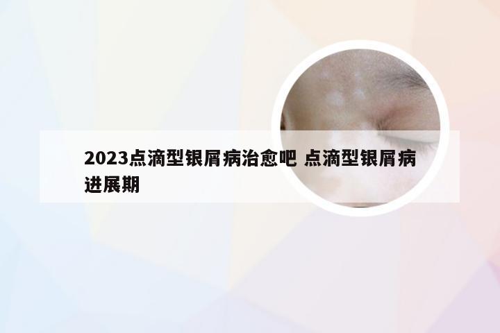 2023点滴型银屑病治愈吧 点滴型银屑病进展期