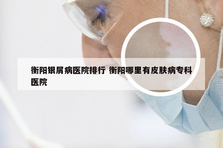 衡阳银屑病医院排行 衡阳哪里有皮肤病专科医院