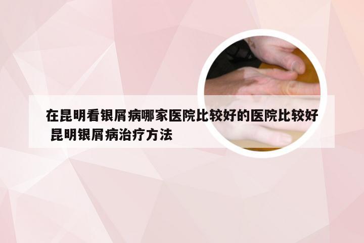 在昆明看银屑病哪家医院比较好的医院比较好 昆明银屑病治疗方法