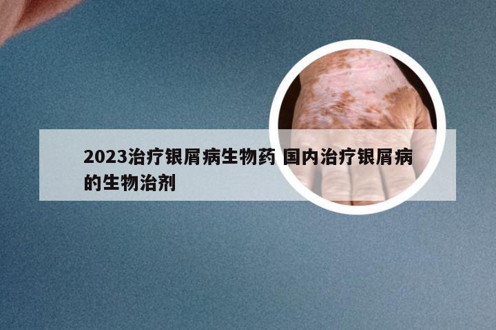 2023治疗银屑病生物药 国内治疗银屑病的生物治剂