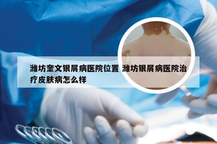 潍坊奎文银屑病医院位置 潍坊银屑病医院治疗皮肤病怎么样