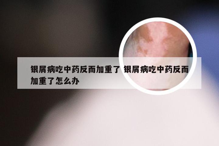 银屑病吃中药反而加重了 银屑病吃中药反而加重了怎么办