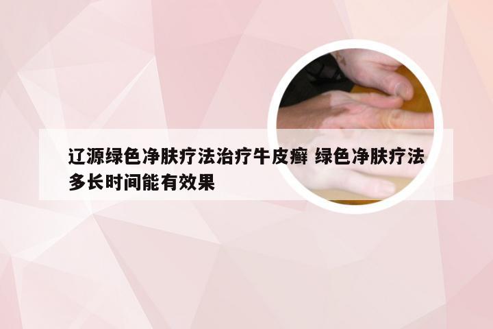 辽源绿色净肤疗法治疗牛皮癣 绿色净肤疗法多长时间能有效果