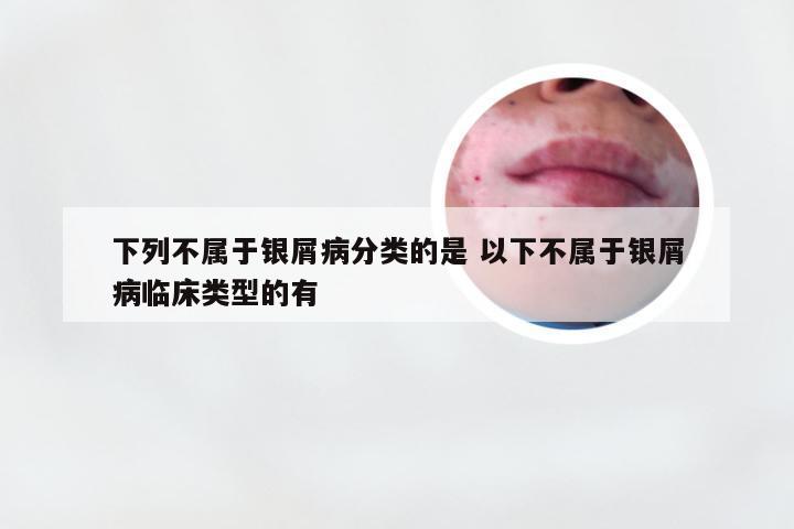 下列不属于银屑病分类的是 以下不属于银屑病临床类型的有