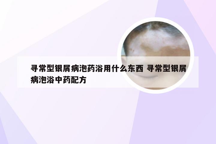 寻常型银屑病泡药浴用什么东西 寻常型银屑病泡浴中药配方