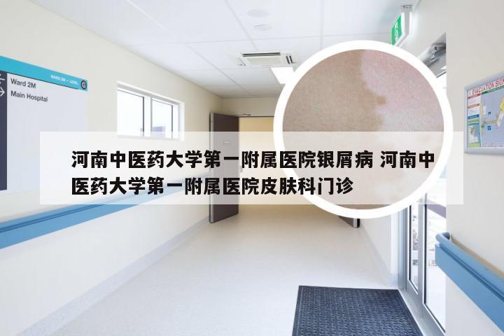 河南中医药大学第一附属医院银屑病 河南中医药大学第一附属医院皮肤科门诊