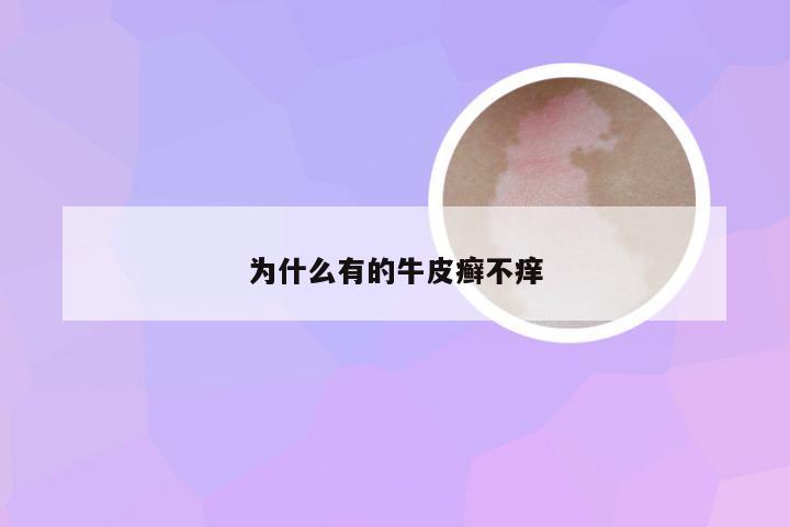 为什么有的牛皮癣不痒