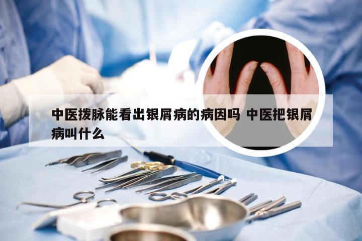 中医拨脉能看出银屑病的病因吗 中医把银屑病叫什么