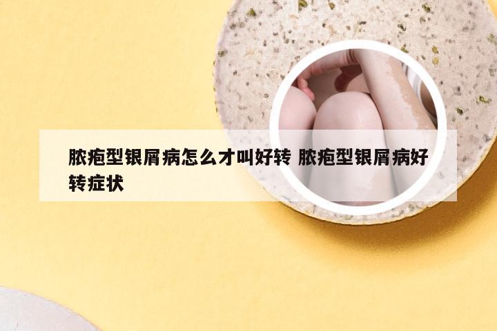 脓疱型银屑病怎么才叫好转 脓疱型银屑病好转症状