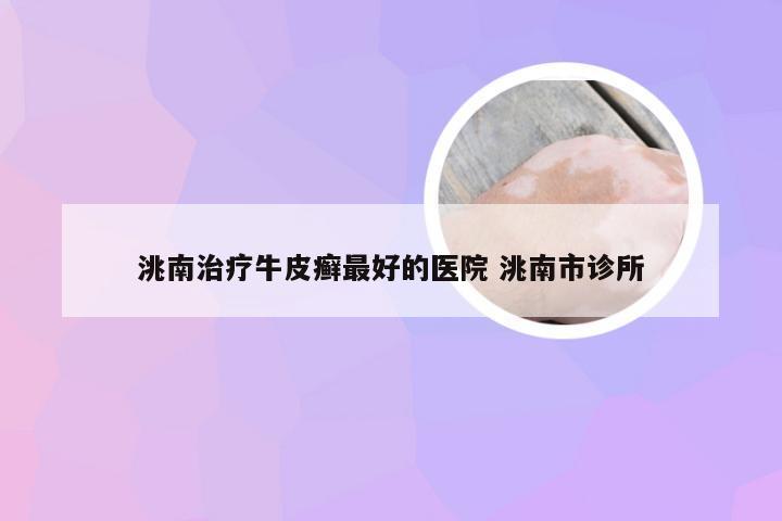 洮南治疗牛皮癣最好的医院 洮南市诊所