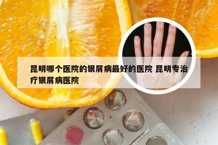 昆明哪个医院的银屑病最好的医院 昆明专治疗银屑病医院