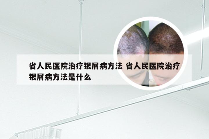 省人民医院治疗银屑病方法 省人民医院治疗银屑病方法是什么