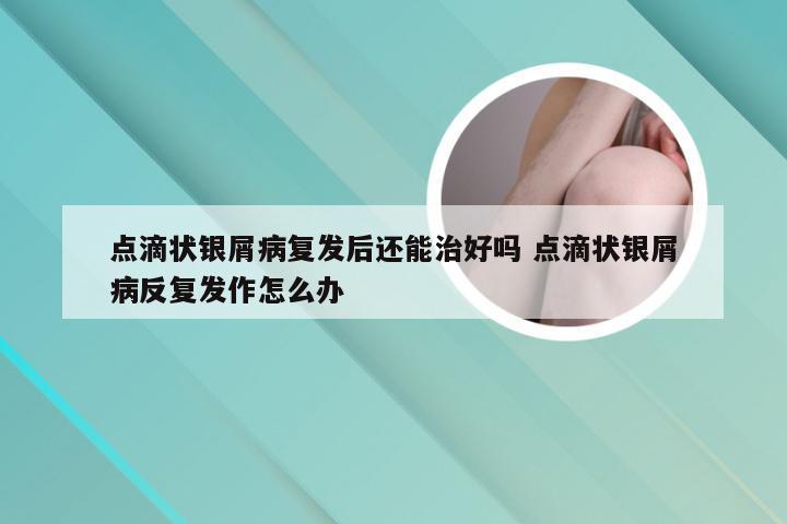 点滴状银屑病复发后还能治好吗 点滴状银屑病反复发作怎么办