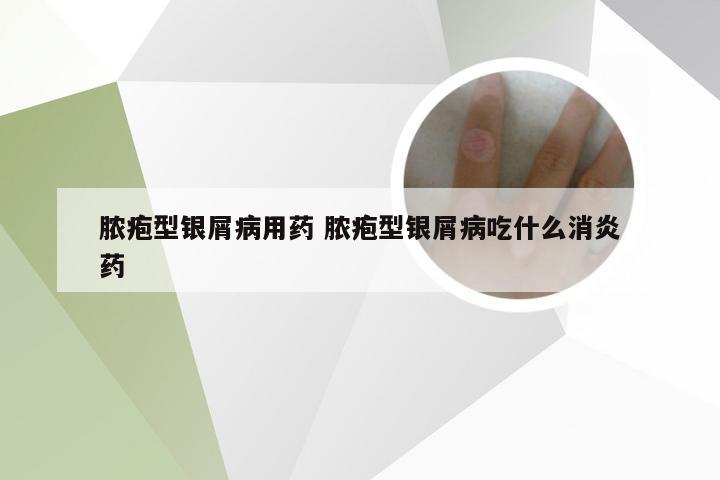 脓疱型银屑病用药 脓疱型银屑病吃什么消炎药