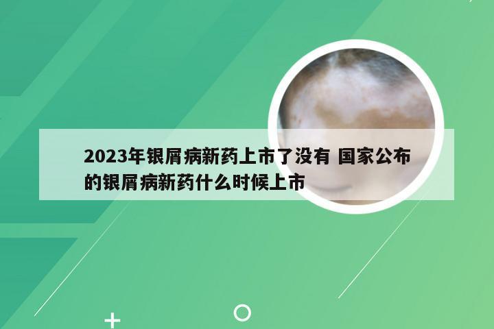 2023年银屑病新药上市了没有 国家公布的银屑病新药什么时候上市