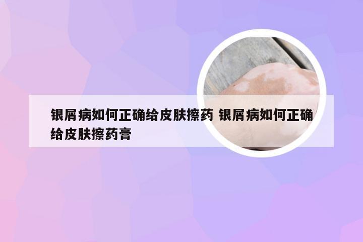 银屑病如何正确给皮肤擦药 银屑病如何正确给皮肤擦药膏