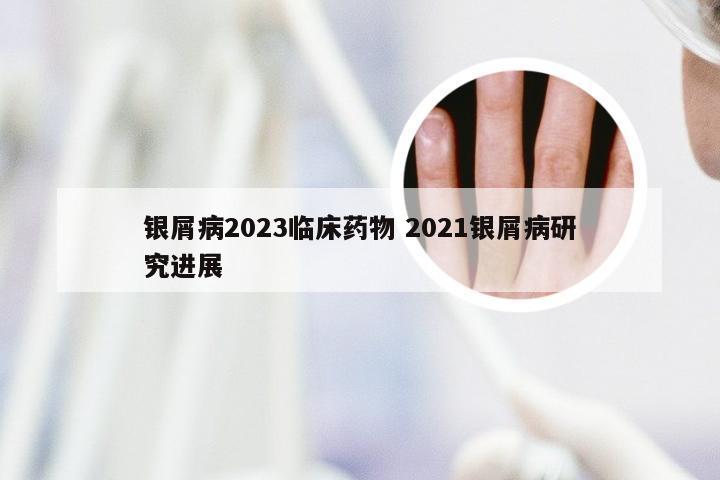 银屑病2023临床药物 2021银屑病研究进展