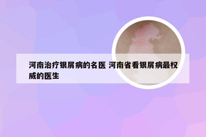 河南治疗银屑病的名医 河南省看银屑病最权威的医生