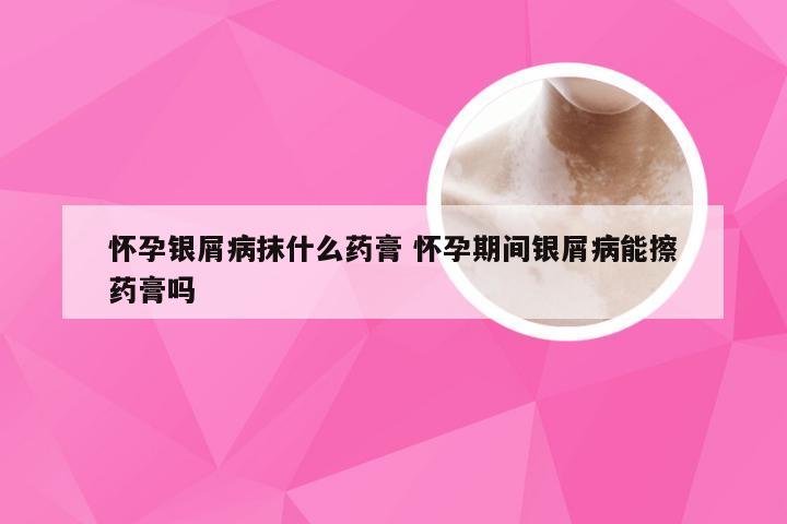 怀孕银屑病抹什么药膏 怀孕期间银屑病能擦药膏吗