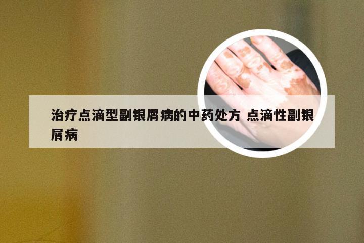 治疗点滴型副银屑病的中药处方 点滴性副银屑病