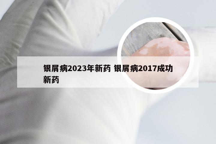 银屑病2023年新药 银屑病2017成功新药