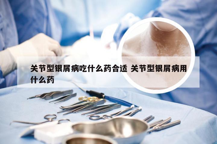 关节型银屑病吃什么药合适 关节型银屑病用什么药